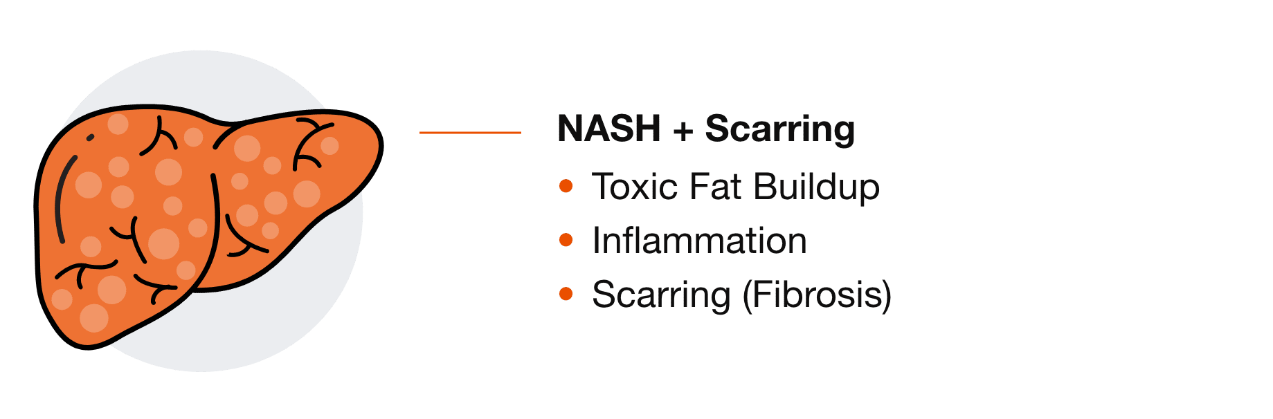 NASH and Scarring: Toxic Fat Buildup, Inflammation, and Scarring (Fibrosis)